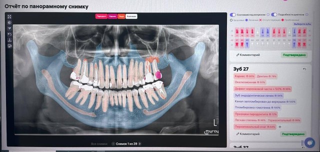 Оренбургская стоматология внедрила ИИ в лечение зубов и костной ткани