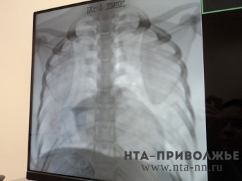 Дышим полной грудью: нижегородский медик дала советы по защите здоровья лёгких