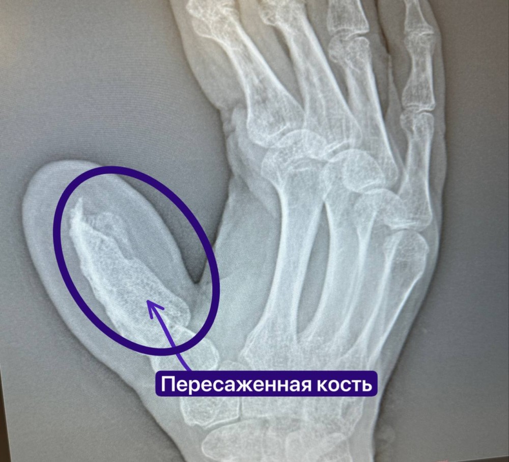 фото: РКБ Татарстана фото: РКБ Татарстана