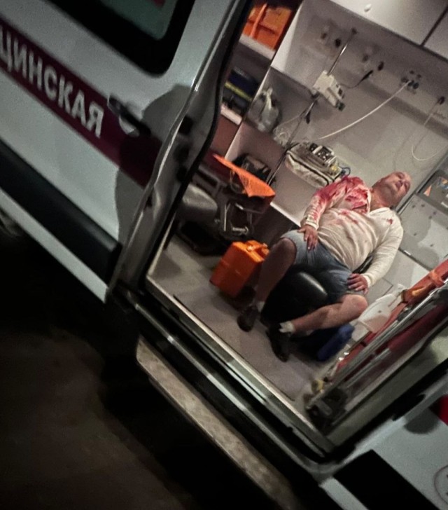 Пранк зашёл не туда: концертного директора уфимской группы ранил медведь